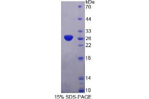 Image no. 1 for Synaptosomal-Associated Protein, 25kDa (SNAP25) (AA 1-206) protein (His tag) (ABIN6238183) (SNAP25 Protein (AA 1-206) (His tag))