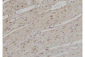 ABIN6264856 and ABIN6279037 at 1/100 staining Rat heart tissue by IHC-P.