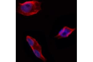 ABIN6258683 and ABIN6274711 staining Hela by IF/ICC. (AGPAT4 anticorps  (Internal Region))