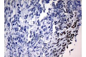 Image no. 9 for anti-Nibrin (NBN) (AA 461-754) antibody (ABIN1491540)