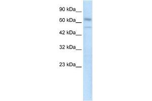 Human kidney; WB Suggested Anti-ZNF306 Antibody Titration: 0. (ZKSCAN3 anticorps  (N-Term))