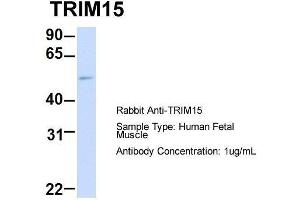 Host: Rabbit  Target Name: TRIM15  Sample Tissue: Human Fetal Muscle  Antibody Dilution: 1. (TRIM15 anticorps  (Middle Region))