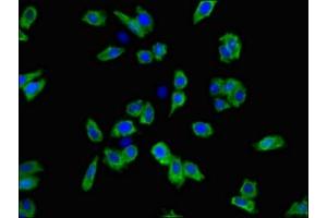 Immunofluorescent analysis of HepG2 cells using ABIN7169976 at dilution of 1:100 and Alexa Fluor 488-congugated AffiniPure Goat Anti-Rabbit IgG(H+L)
