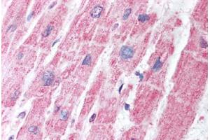 Human Heart (formalin-fixed, paraffin-embedded) stained with MDH1 antibody ABIN291679 at 5 ug/ml followed by biotinylated secondary antibody, alkaline phosphatase-streptavidin and chromogen. (MDH1 anticorps)