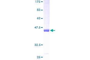 Image no. 1 for Interleukin 18 Binding Protein (IL18BP) (AA 31-194) protein (GST tag) (ABIN1307724)