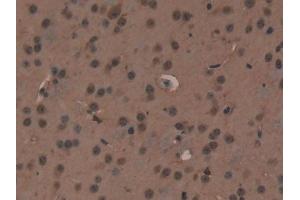 Detection of XRCC6 in Mouse Heart Tissue using Polyclonal Antibody to X-Ray Repair Cross Complementing 6 (XRCC6)