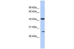 KCNMB4 antibody used at 1 ug/ml to detect target protein. (KCNMB4 anticorps  (Middle Region))