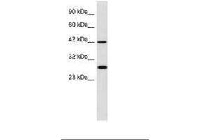 Image no. 1 for anti-Proteasome (Prosome, Macropain) 26S Subunit, Non-ATPase, 4 (Psmd4) (AA 92-141) antibody (ABIN202377) (PSMD4/ASF anticorps  (AA 92-141))