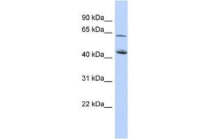 WB Suggested Anti-C5orf33 Antibody Titration: 0. (NADK2 anticorps  (Middle Region))