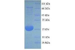 Adiponectin, C1Q and Collagen Domain Containing (ADIPOQ) (AA 18-240), (full length) protein (His tag)