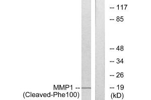 Western blot analysis of extracts from 549 cells, treated with etoposide (25uM, 24hours), using MMP1 (Cleaved-Phe100) antibody. (MMP1 anticorps  (Cleaved-Phe100))