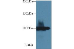 Western Blot; Sample: Rat Kidney lysate; Primary Ab: 1µg/ml Rabbit Anti-Rat ENPP1 Antibody Second Ab: 0.