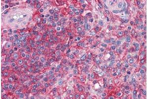 Human Spleen: Formalin-Fixed, Paraffin-Embedded (FFPE)