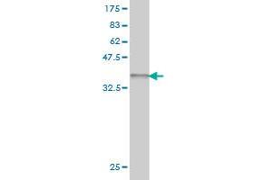 Western Blot detection against Immunogen (37.