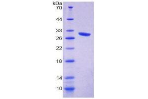 SDS-PAGE (SDS) image for Von Willebrand Factor A Domain Containing 1 (VWA1) (AA 135-366) protein (His tag) (ABIN2127240)