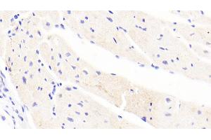 Detection of Hepc in Human Cardiac Muscle Tissue using Polyclonal Antibody to Hepcidin (Hepc)