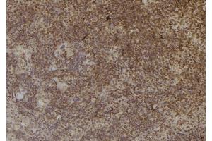 ABIN6274965 at 1/100 staining Mouse spleen tissue by IHC-P. (CBR3 anticorps  (C-Term))