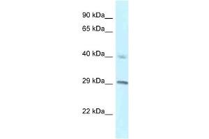 Western Blot showing RCC1 antibody used at a concentration of 1 ug/ml against NCI-H226 Cell Lysate (RCC1 anticorps  (C-Term))