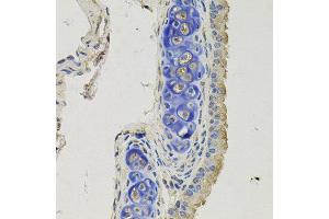 Immunohistochemistry of paraffin-embedded mouse lung using GPHN antibody at dilution of 1:100 (x40 lens). (Gephyrin anticorps)