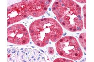 FAH antibody was used for immunohistochemistry at a concentration of 4-8 ug/ml. (FAH anticorps)