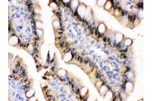 Anti- liver FABP Picoband antibody,IHC(P) IHC(P): Rat Intestine Tissue