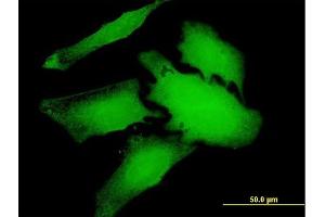 Immunofluorescence of purified MaxPab antibody to WDR66 on HeLa cell.