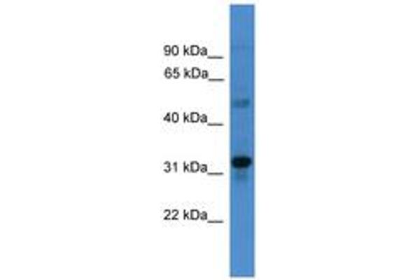 TMEM176B anticorps  (C-Term)