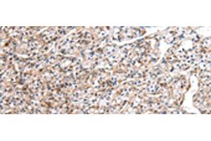 anti-DDB1 and CUL4 Associated Factor 7 (DCAF7) antibody