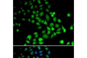 Immunofluorescence analysis of U2OS cells using PARN Polyclonal Antibody (PARN anticorps)