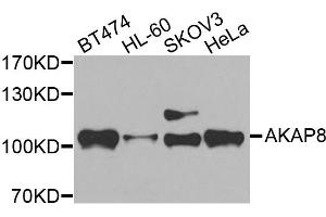 Western blot analysis of extracts of various cell lines, using AKAP8 antibody. (AKAP8 anticorps)