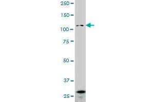 PCDHGA2 monoclonal antibody (M01A), clone 2A7. (PCDHGA2 anticorps  (AA 223-331))