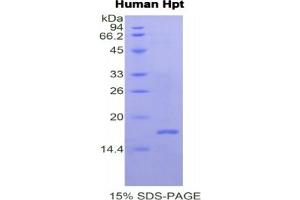 SDS-PAGE of Protein Standard from the Kit (Highly purified E. (Haptoglobin Kit CLIA)