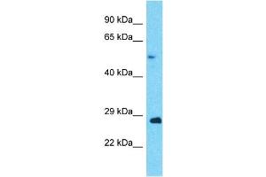 Host:  Rabbit  Target Name:  ANAPC5  Sample Type:  Ovary Tumor lysates  Antibody Dilution:  1. (ANAPC5 anticorps  (Middle Region))