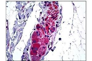 Human Intestine, Ganglion Cells: Formalin-Fixed, Paraffin-Embedded (FFPE) (HDAC6 anticorps  (N-Term))