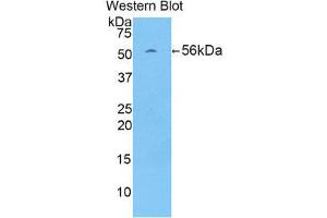 Western Blotting (WB) image for anti-Protein L-Myc (MYCL) (AA 186-439) antibody (ABIN1859918) (LMYC anticorps  (AA 186-439))