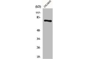 Western Blot analysis of COLO205 cells using HLX1 Polyclonal Antibody (HLX anticorps  (C-Term))
