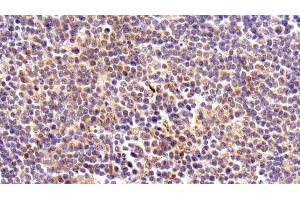 Detection of KMO in Human Lymph node Tissue using Polyclonal Antibody to Kynurenine-3-Monooxygenase (KMO)