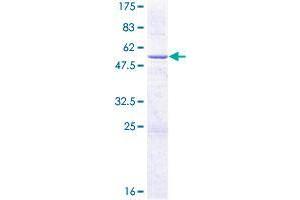 Image no. 1 for Cytochrome B5 Reductase 2 (CYB5R2) (AA 1-237) protein (GST tag) (ABIN1350881)