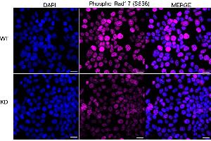 Immunocytochemical staining of HeLa cells using Phospho-Rad17 (S656) antibody (ABIN7800113), 1:1,000), Top panel: wild-type (WT), Bottom panal: Phospho-Rad17 (S656) shRNA knockdown (KD). (Recombinant RAD17 anticorps  (pSer656))