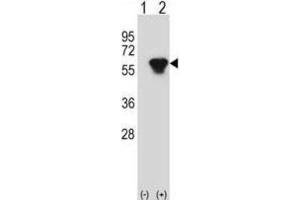 Western Blotting (WB) image for anti-Protein Kinase, CAMP-Dependent, Regulatory, Type II, beta (PRKAR2B) antibody (ABIN2998379) (PRKAR2B anticorps)