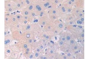 Used in DAB staining on fromalin fixed paraffin- embedded kidney tissue (IL3RA anticorps  (AA 19-158))