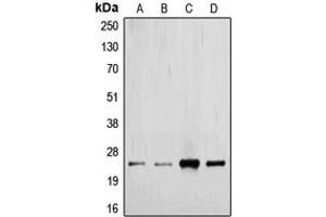 Western blot analysis of TGF beta 2 expression in MCF7 (A), HeLa (B), mouse kidney (C), rat placenta (D) whole cell lysates. (TGFB2 anticorps  (C-Term))