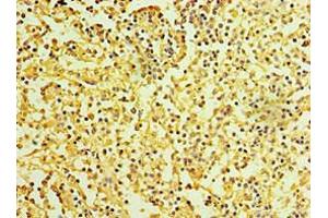 Immunohistochemistry of paraffin-embedded human spleen tissue using ABIN7156877 at dilution of 1:100 (IL27 Receptor alpha anticorps  (AA 33-283))