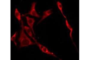 ABIN6276245 staining HeLa by IF/ICC. (OR10R2 anticorps  (C-Term))