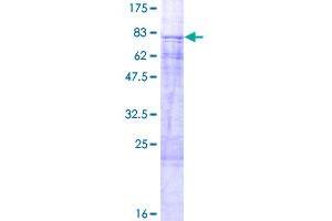 Image no. 1 for Transcription Factor Dp-1 (TFDP1) (AA 1-410) protein (GST tag) (ABIN1322550)