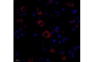 Immunofluorescence of paraffin embedded mouse spinal cord using NACAD (ABIN7074756) at dilution of 1:650 (400x lens)