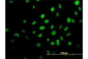 Immunofluorescence of monoclonal antibody to TRIM36 on HeLa cell. (TRIM36 anticorps  (AA 391-499))
