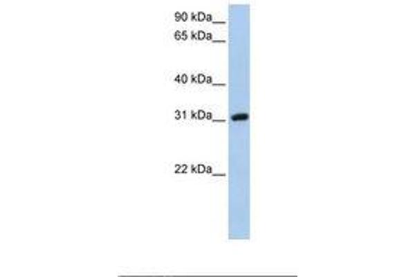Dickkopf-Like 1 (DKKL1) (C-Term) anticorps