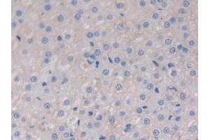 Detection of JNK1 in Rat Adrenal gland Tissue using Polyclonal Antibody to c-Jun N-terminal Kinase 1 (JNK1)