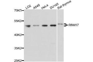 Western blot analysis of extracts of various cell lines, using RBM17 antibody. (RBM17 anticorps  (AA 1-240))